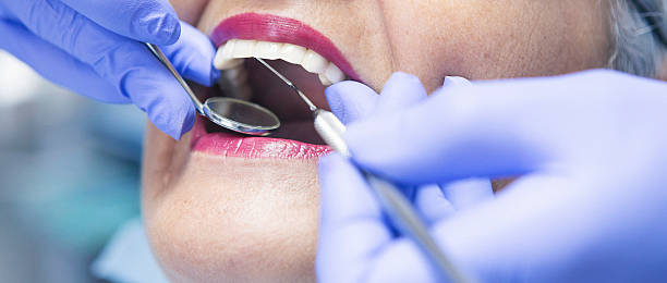 Best Emergency Dental Care for Broken or Chipped Teeth in Payson, UT